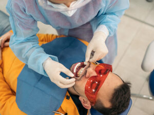 clareamento dental