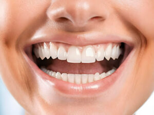dentística