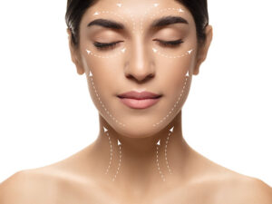 harmonização facial