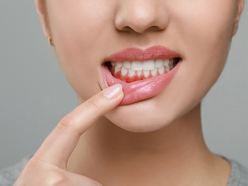 periodontia