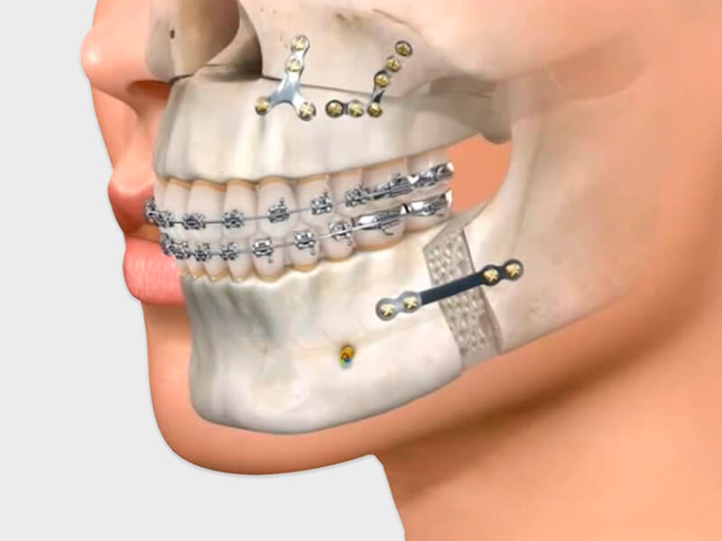 cirurgia oral