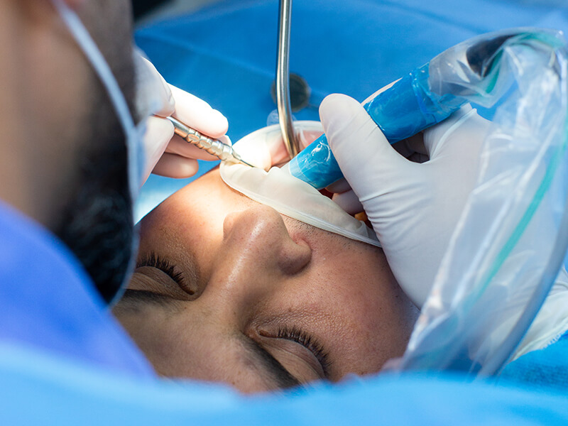 cirurgia oral