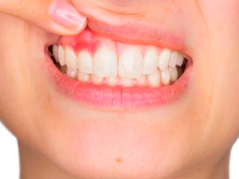 periodontia