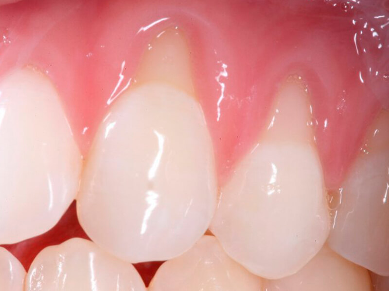 periodontia